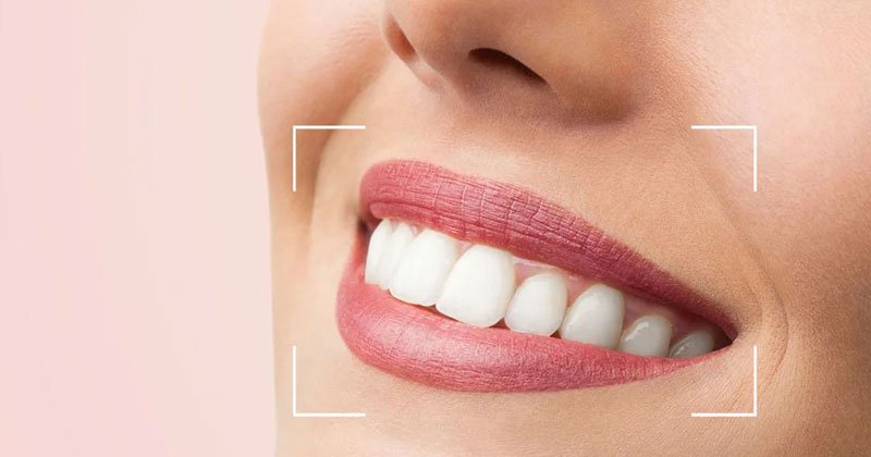 Complete Smile Designing