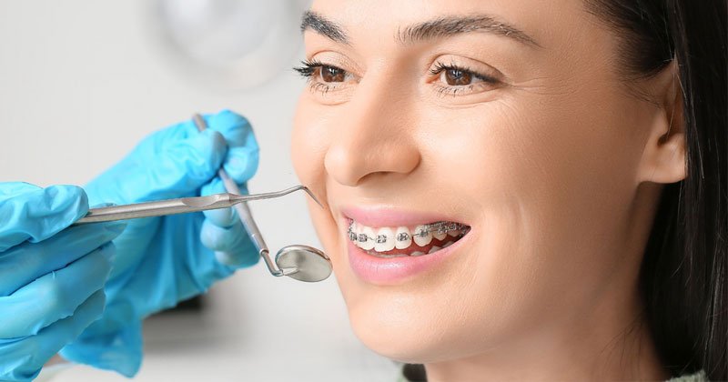 Orthodontics Treatment