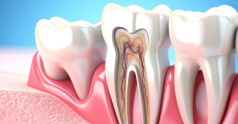 Root Canal Treatment